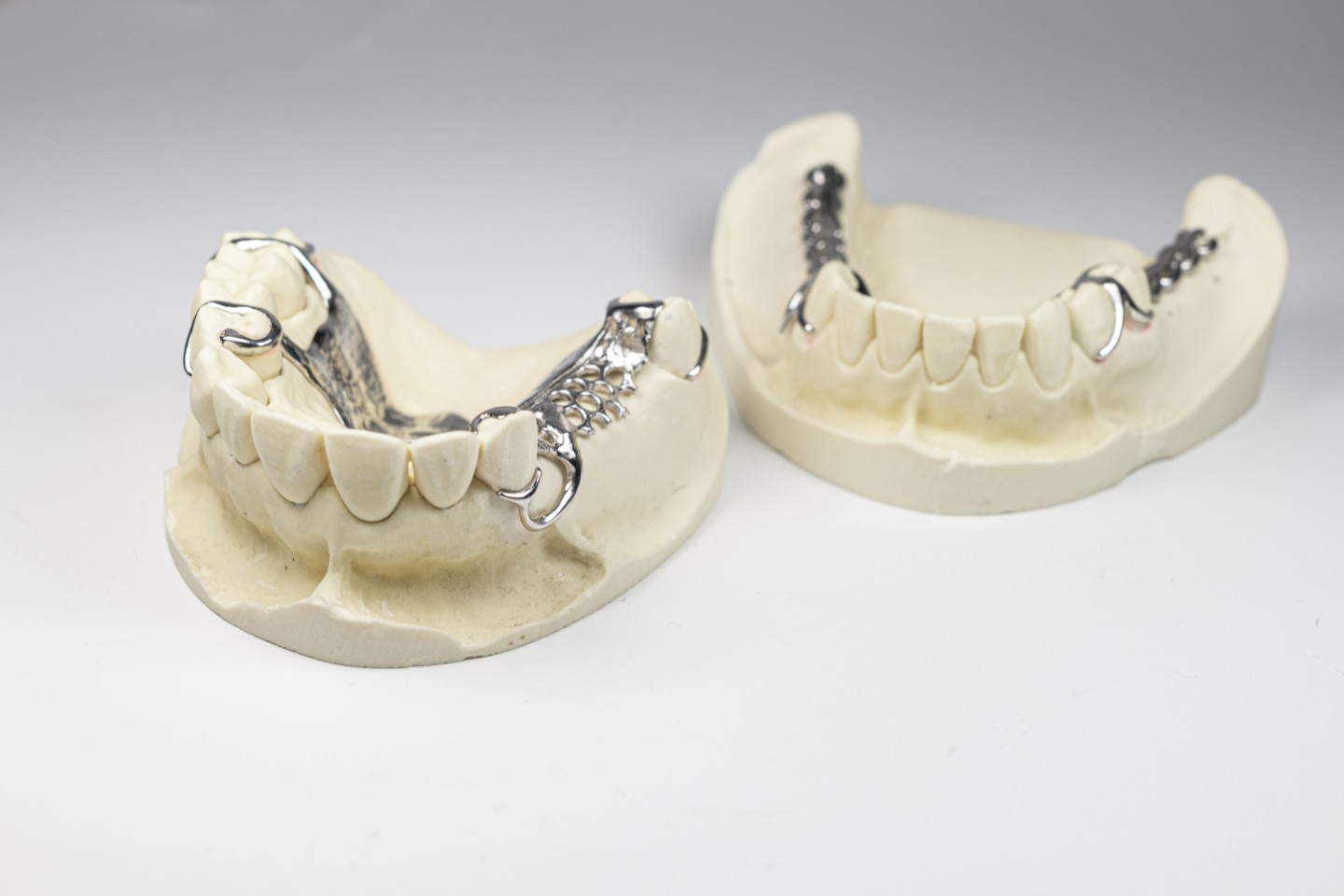 Additiv gefertigte Zahnprothese