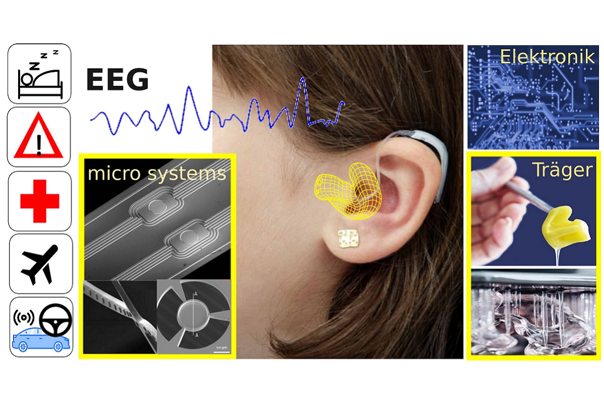 Neue bioelektronische Langzeit-EEG-Elektroden im Ohr